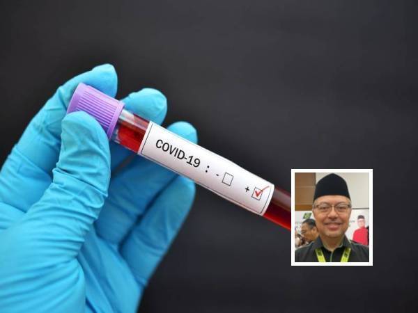 Tiga bakal jemaah haji positif Covid-19
